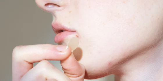 Pimple Patch Tips: How To Use For Clear Skin